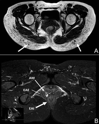 248- Fig 3 L.JPG