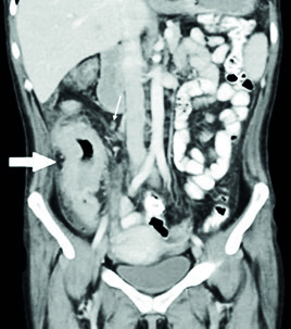 Figura 3